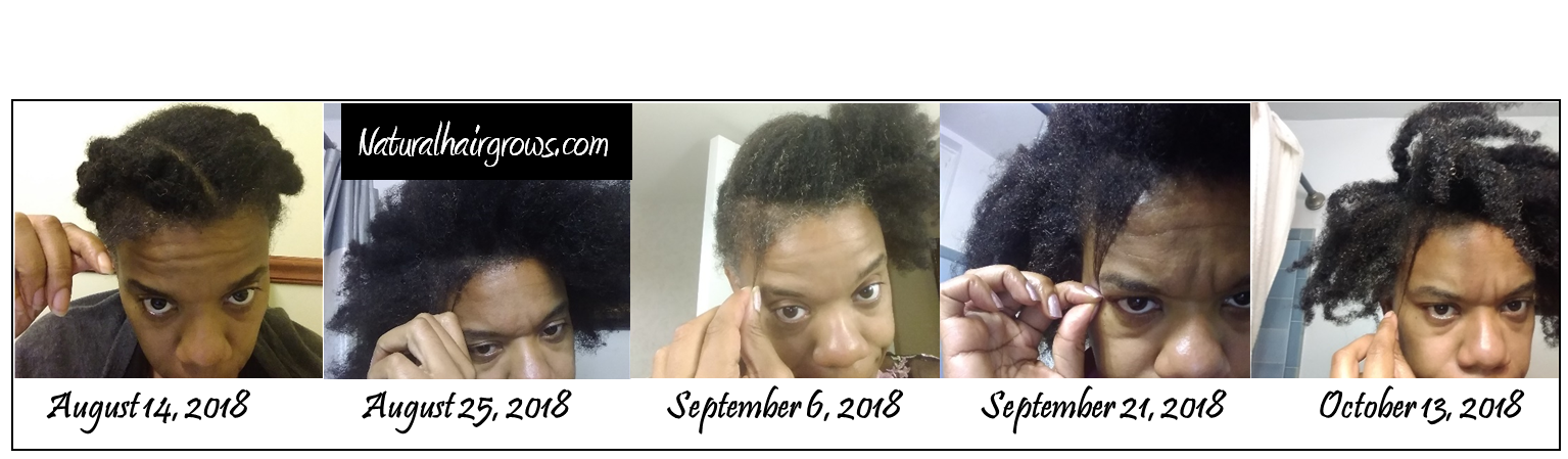 August to October 2018 Hair Growth with Black Seed Oil