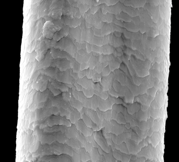 Hair under Scanning Electron Microscope