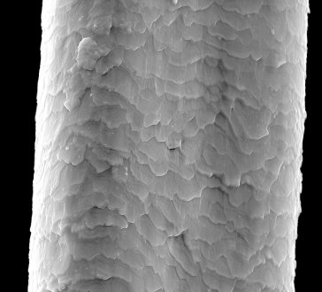 Hair under Scanning Electron Microscope