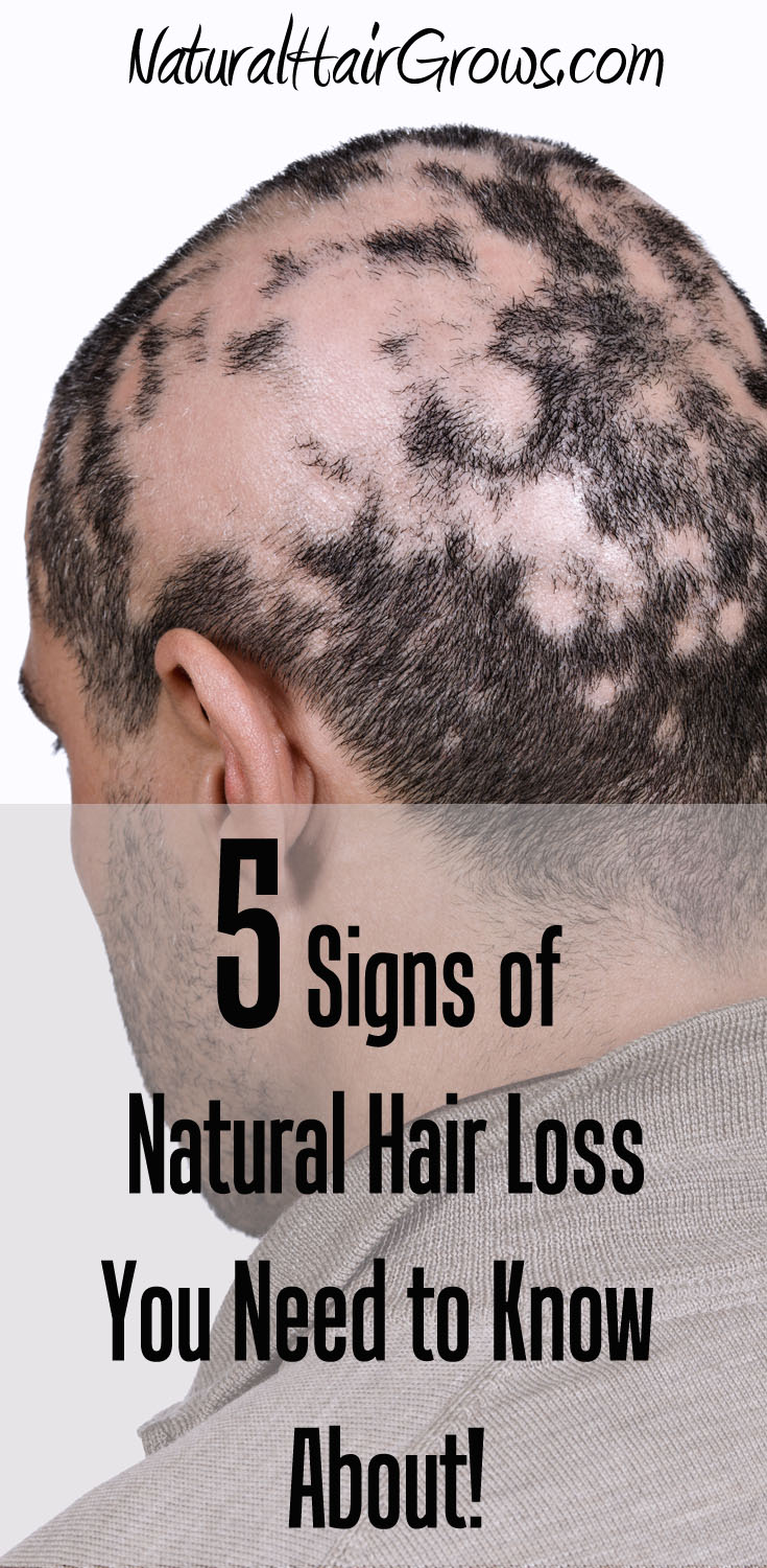Natural Hair Grows Natural Hair Grows